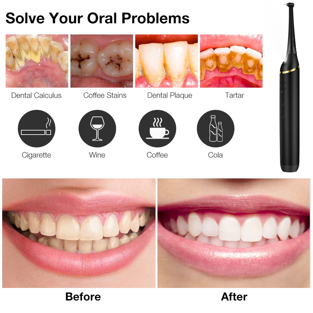 Rechargeable Ultrasonic Dental Scaler For Tartar And Plaque Removal