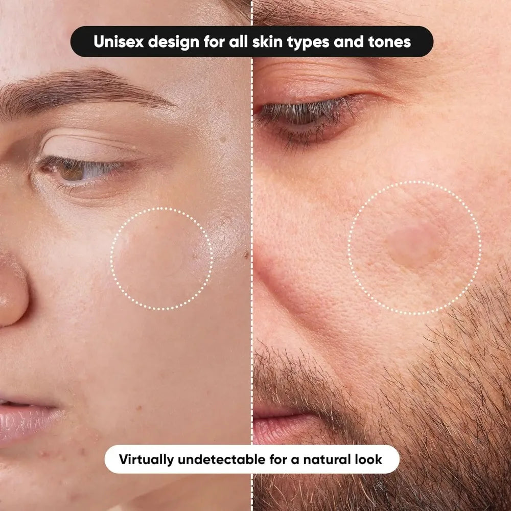 800-Piece Acne Patches | Hydrocolloid Round Acne Patches | Powerful Absorption of Acne Secretions, Gentle Cleansing an