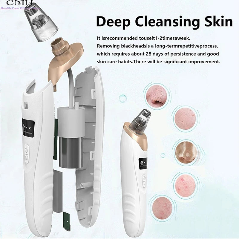 CMH Blackhead Remover Vacuum Pore Cleaner With Adjustable Suction