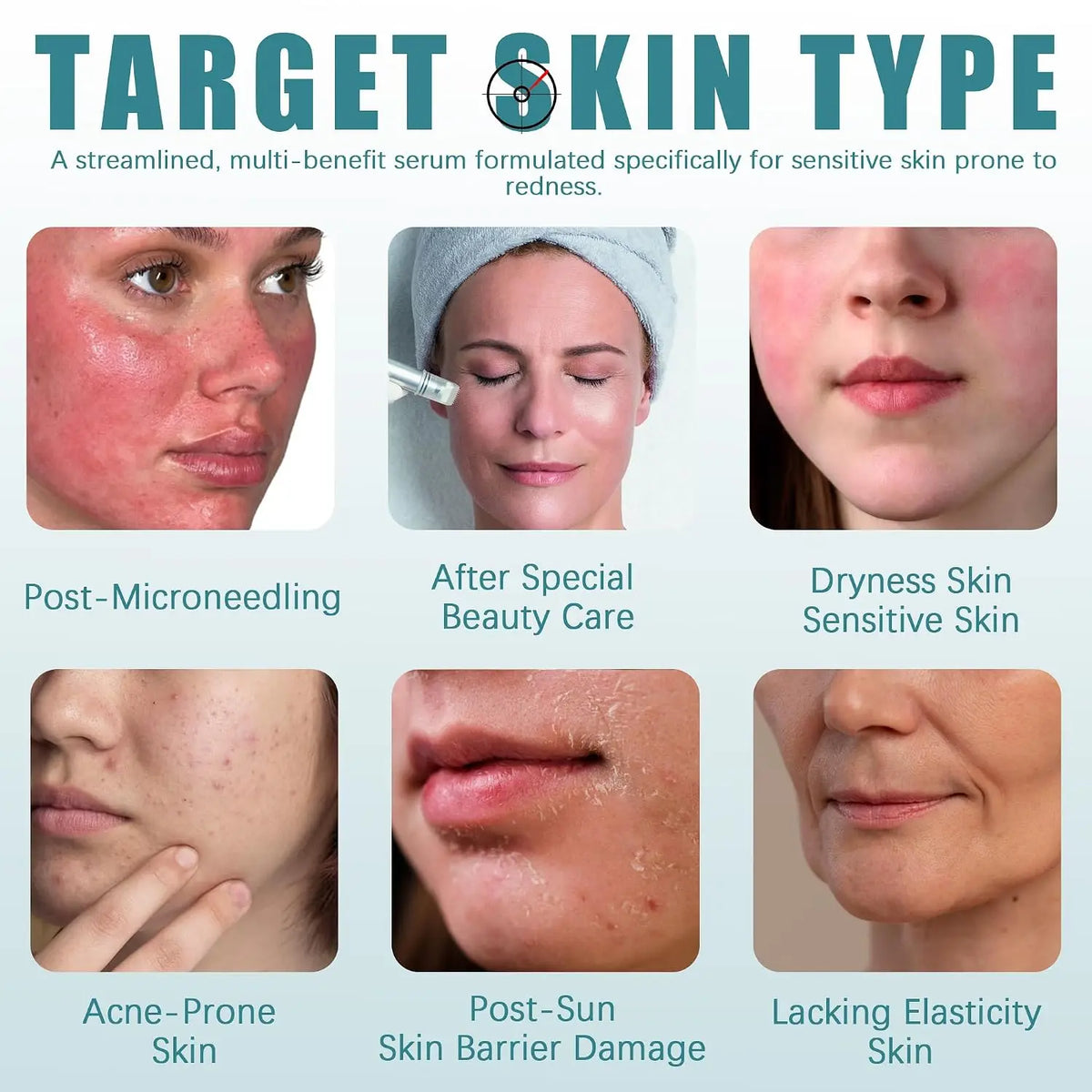Post Microneedling Hydration Serum With Tremella Collagen For Sensitive Skin