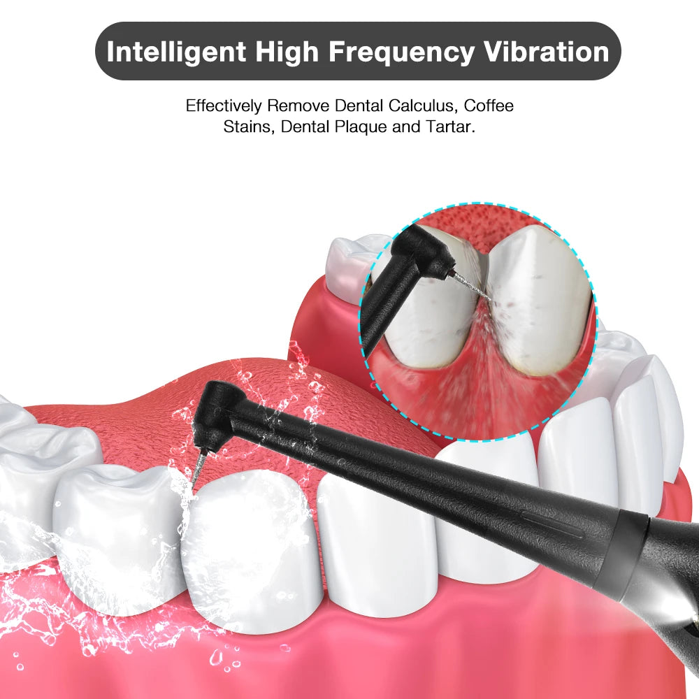 Rechargeable Ultrasonic Dental Scaler For Tartar And Plaque Removal