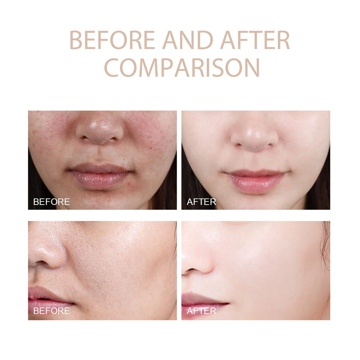 Ouhoe Deep Cleansing Facial Exfoliating Gel for Blackhead Removal