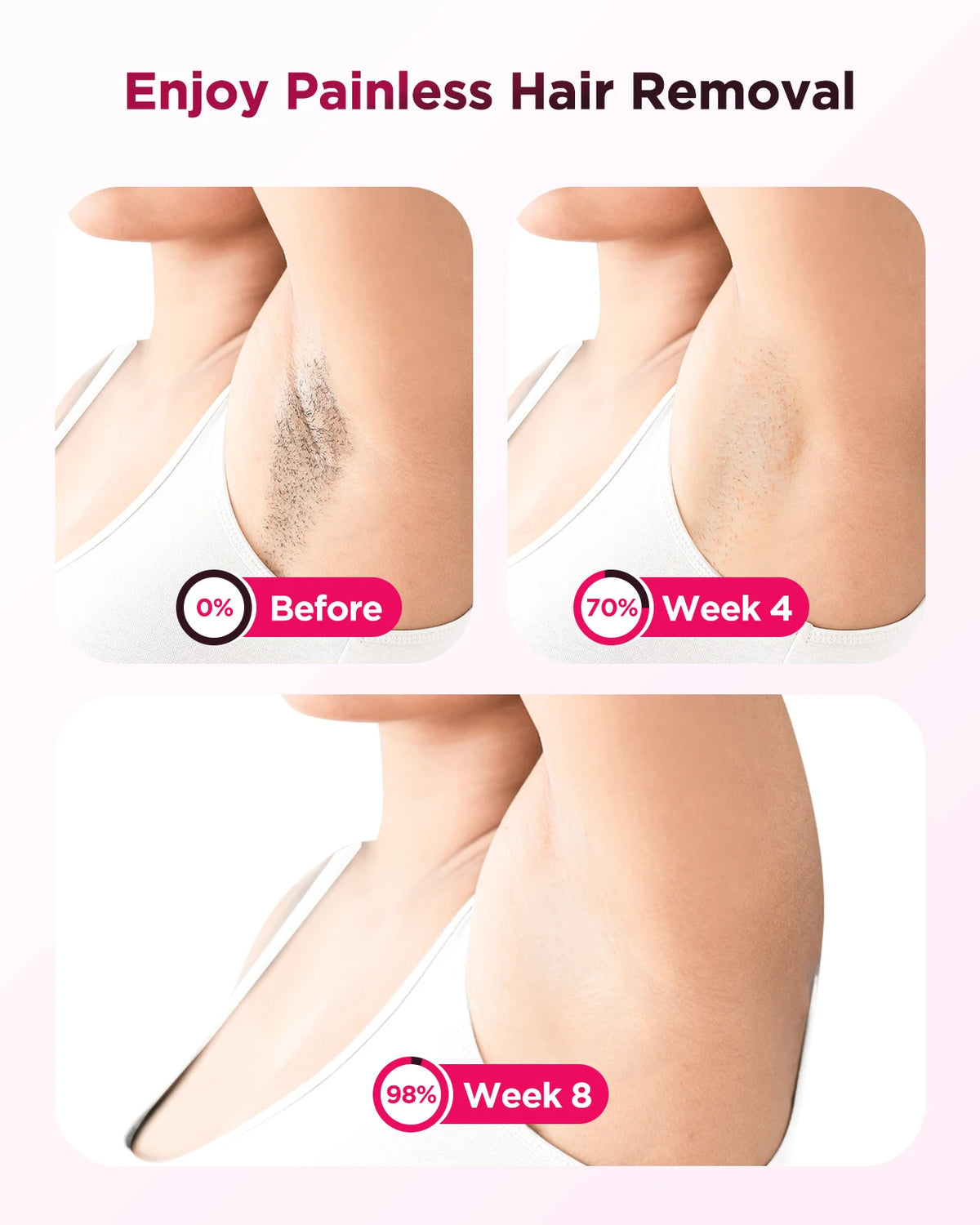 Totmizby IPL Laser Hair Removal Device for Face and Body