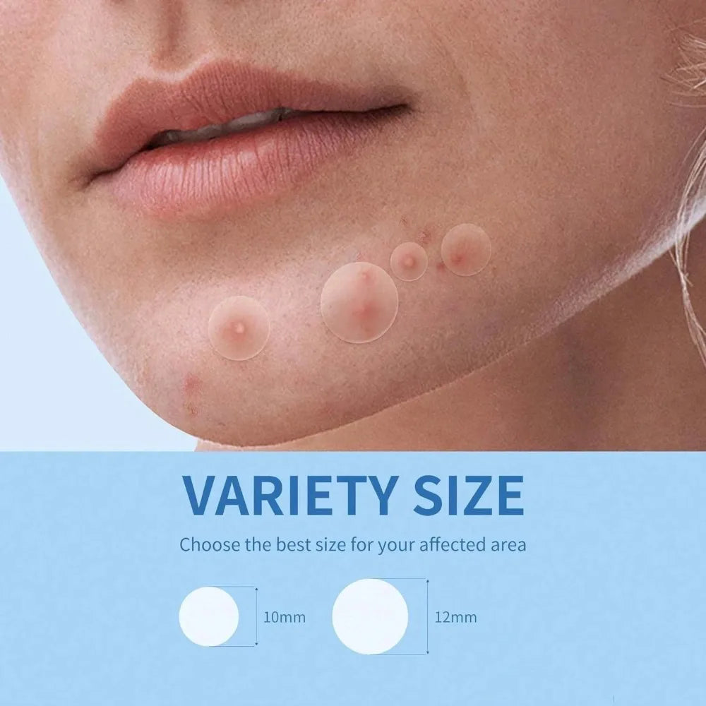 800-Piece Acne Patches | Hydrocolloid Round Acne Patches | Powerful Absorption of Acne Secretions, Gentle Cleansing an