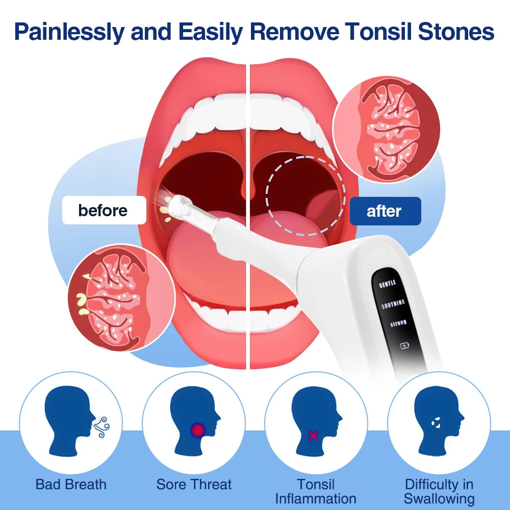 Hailicare Electric Tonsil Stone Removal Tool With Adjustable Suction