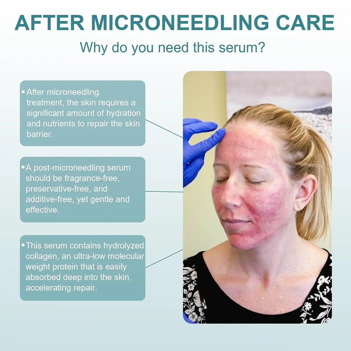 Post Microneedling Hydration Serum With Tremella Collagen For Sensitive Skin
