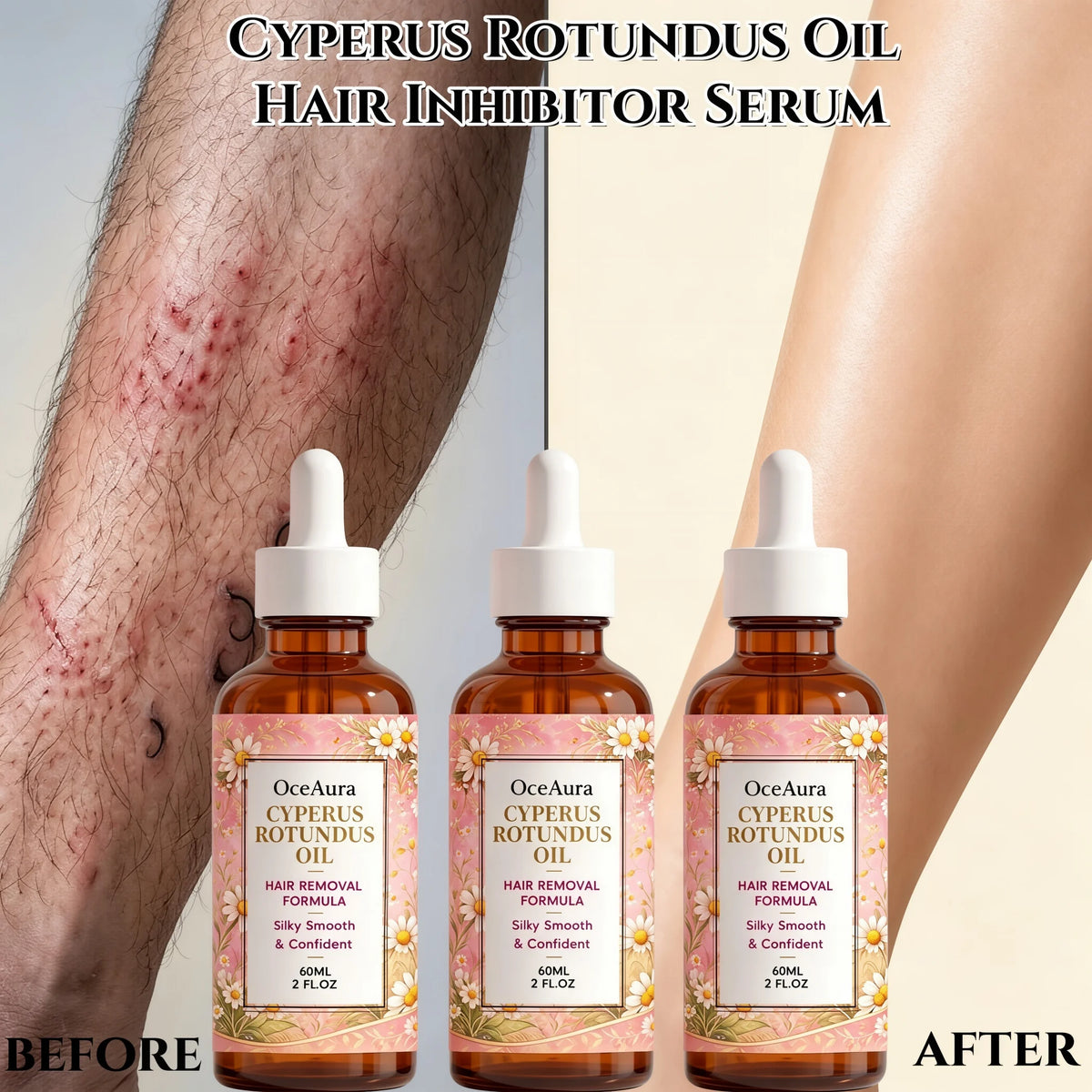 OceAura Cyperus Rotundus Hair Inhibitor Serum for Smooth Skin