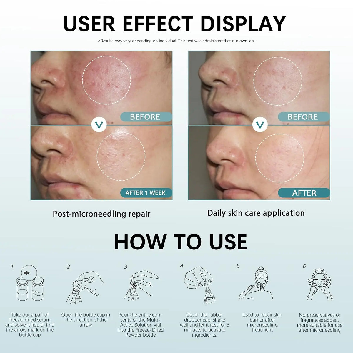 Post Microneedling Hydration Serum With Tremella Collagen For Sensitive Skin