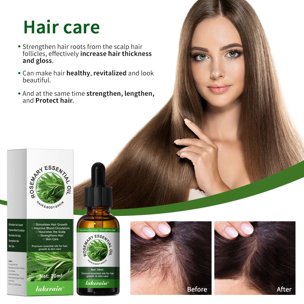 Lakerain Rosemary Essential Oil For Hair Scalp And Skin Care