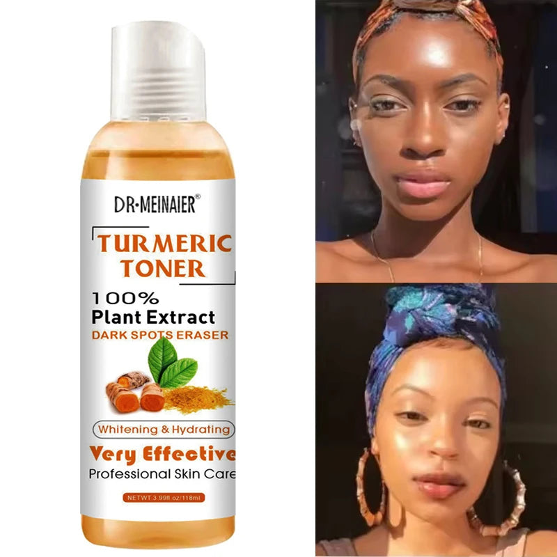 Turmeric Vitamin C Brightening Toner Serum For Dark Spots
