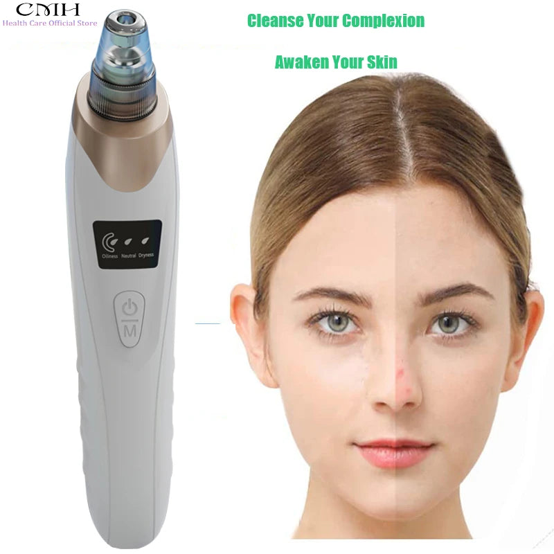 CMH Blackhead Remover Vacuum Pore Cleaner With Adjustable Suction